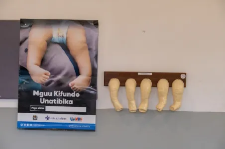 Modelle für die Behandlung nach Ponseti