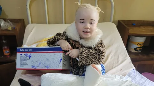 5-jähriges Mädchen mit Albinismus nach X-Bein-Korrektur